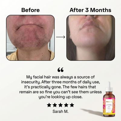 Blousom™ Cyperus Rotundus Serum