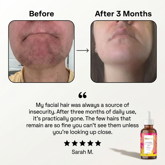 Blousom™ Cyperus Rotundus Serum