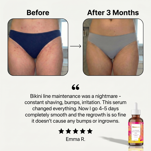 Blousom™ Cyperus Rotundus Serum